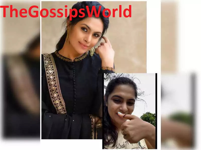 Who Is SONU SRIVASTAVA GOWDA Video Viral  She Indulges In Some Leech Therapy At Sakleshpur  - 91