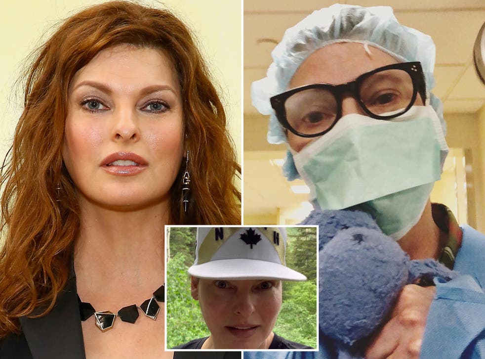 PICTURES  Linda Evangelista Plastic Surgery Photos   Video Went Viral All Over The Social Media  Leaves Everyone Scandalized  - 30