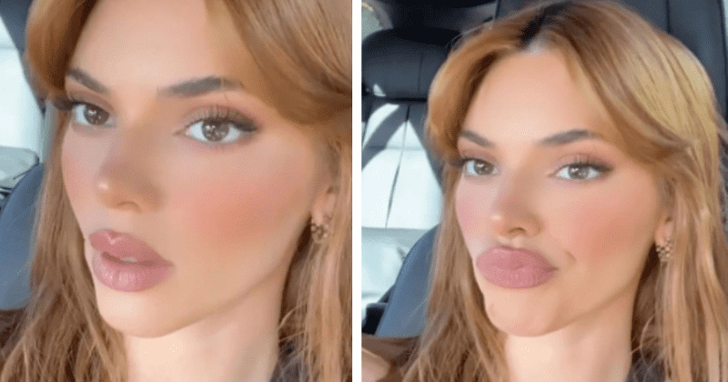 Kendall Jenner Trolled For Big Lips  Watch Viral Photos   Video On Instagram  Twitter   YouTube  - 86