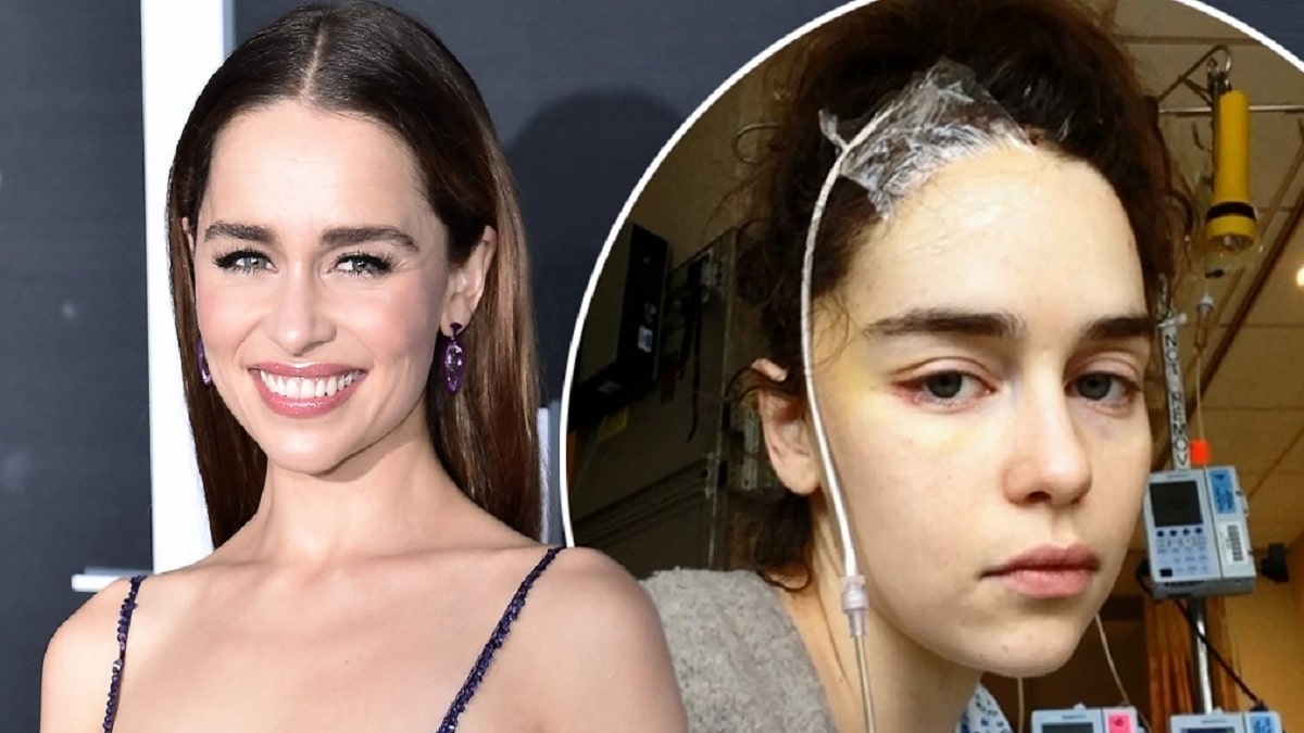 Does Emilia Clarke Struggling With Aphasia? Stroke Horrors & Brain Surgery Details Explained!