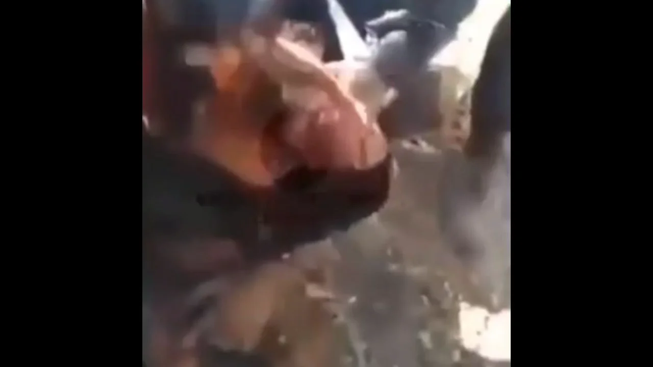 Face Burnt Alive Video Viral On Twitter