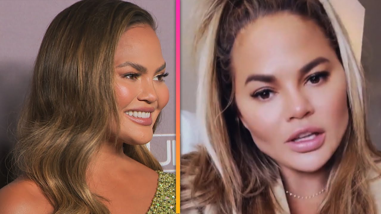 Chrissy Teigen Nose Job  Did Chrissy Teigen Have Done Nose Job   Botox Surgery  Before   After Pics Went Viral  - 97