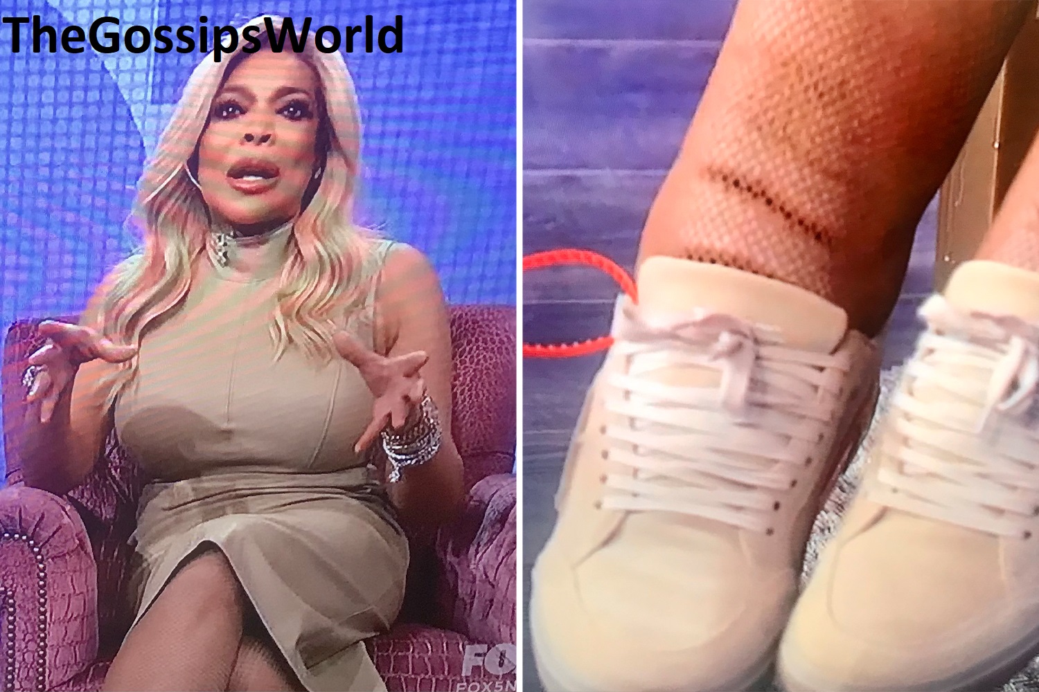 DETAILS  Who Is Wendy Williams  What Happened To Her Feet  Is She Battling Lymphedema  - 12