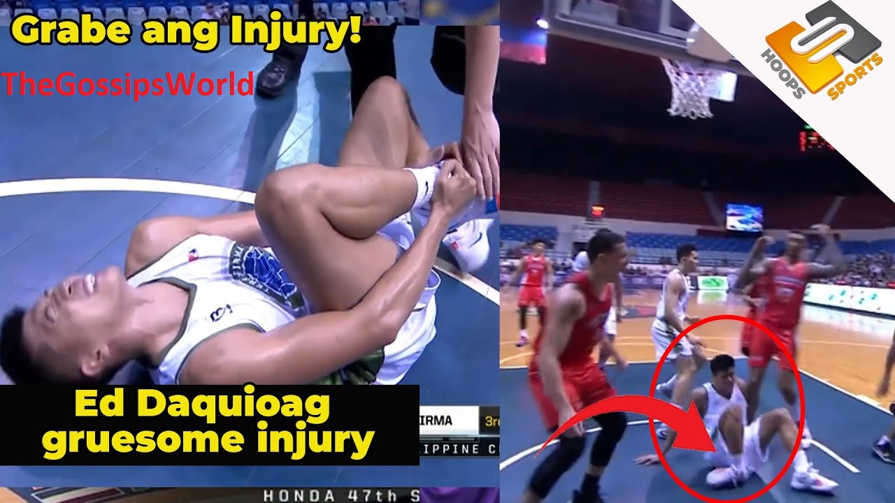 Ed Daquioag Injury VIdeo  What Happened To Ed Daquioag  Injury Update  Suffers Severe Injury After Bad Fall  CCTV Footage  - 72